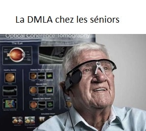 La DMLA chez les personnes âgées