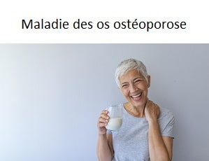 Altérations des os ostéoporose chez les personnes âgées